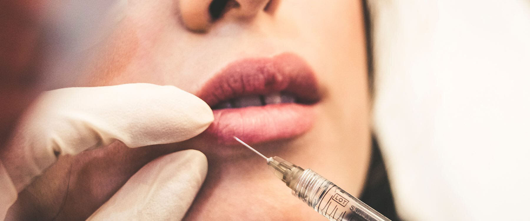 Fact-Checking Common Myths About Lip Fillers