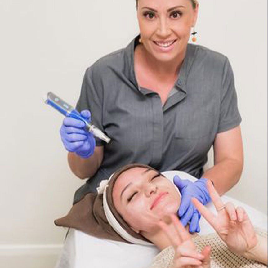 microneedling at st George med spa