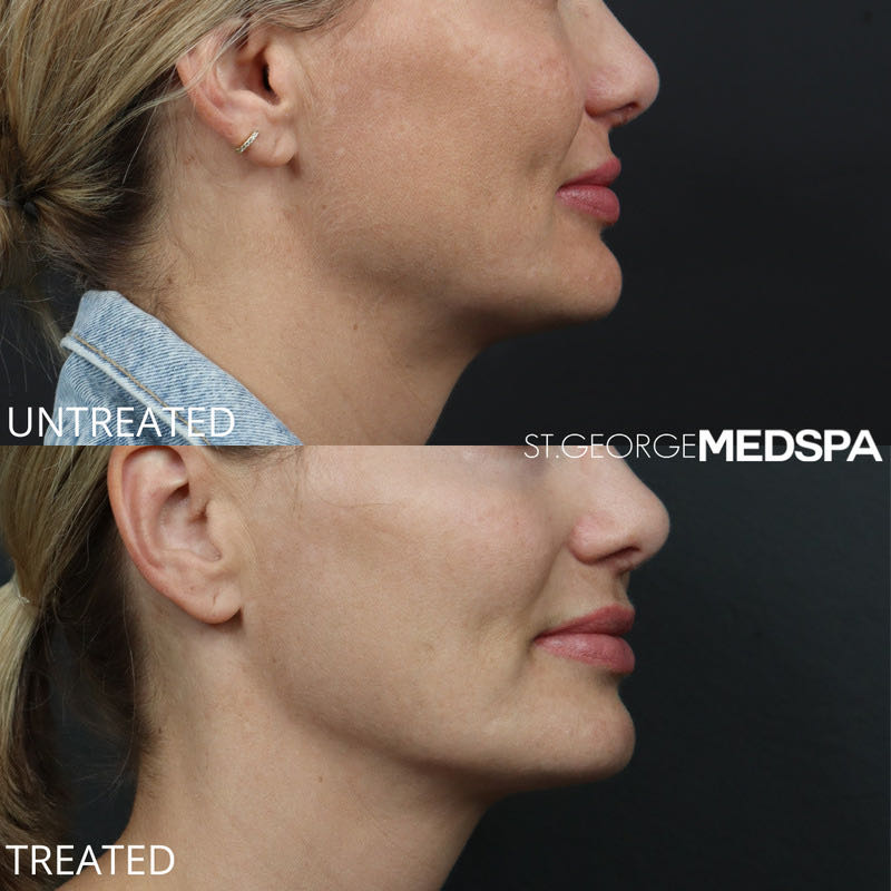 Pigment Correction Before & After Image