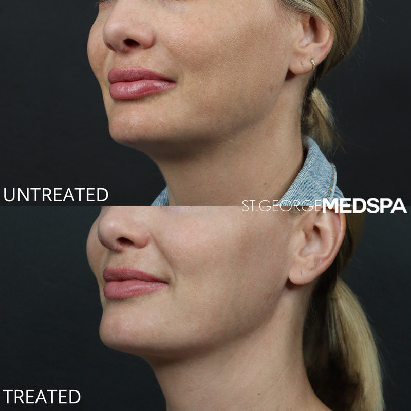 Pigment Correction Before & After Image