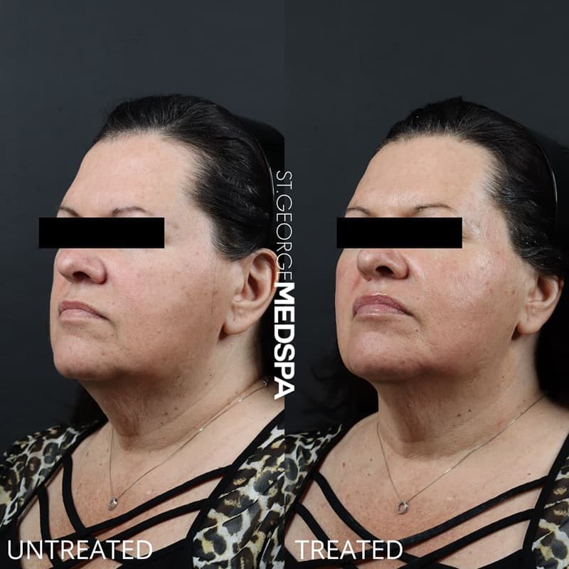 Skin Treatments Before & After Image